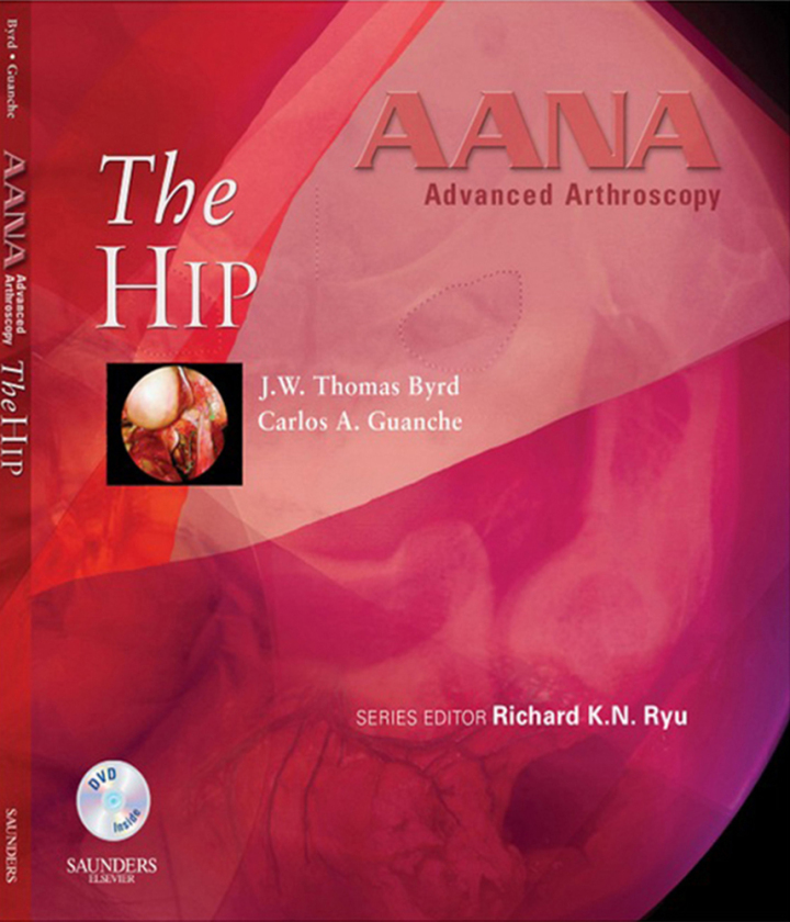AANA Advanced Arthroscopy: The Hip