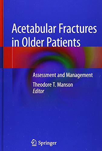 Acetabular Fractures in Older Patients