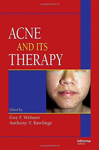 Acne and Its Therapy