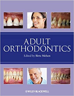 Adult Orthodontics