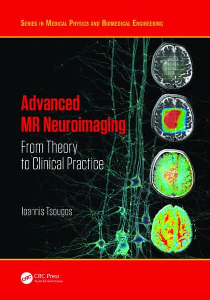 Advanced MR Neuroimaging: From Theory to Clinical Practice by Ioannis Tsougos