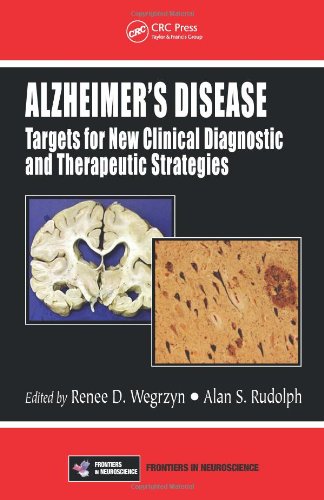 Alzheimer?s Disease