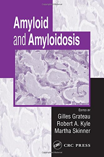 Amyloid and Amyloidosis