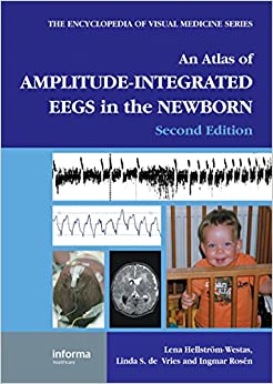 An Atlas of Amplitude-Integrated EEGs in the Newborn (Encyclopedia of Visual Medicine Series)