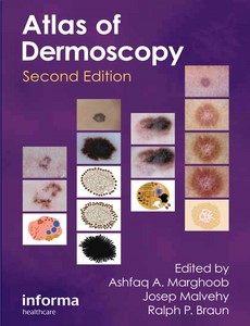 An Atlas of Dermoscopy, Second Edition by Ashfaq Marghoob