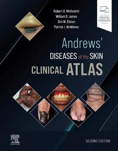 Andrews' Diseases of the Skin Clinical Atlas,, 2nd Edition