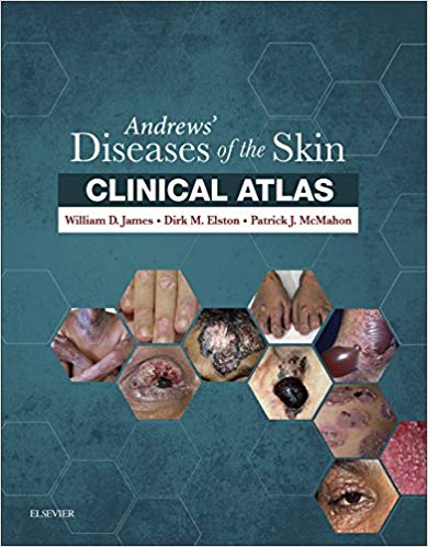 Andrews? Diseases of the Skin Clinical Atlas: Expert Consult Har/Psc Edition ?