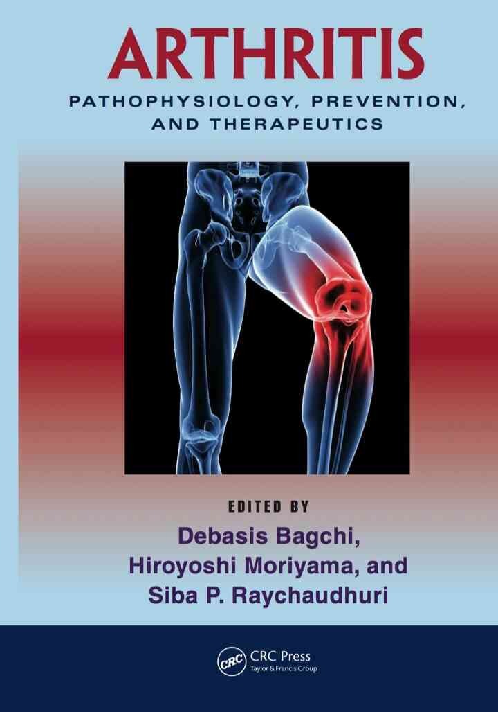 Arthritis: Pathophysiology, Prevention, and Therapeutics, 1st Edition