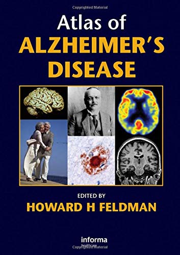 Atlas of Alzheimer?s Disease