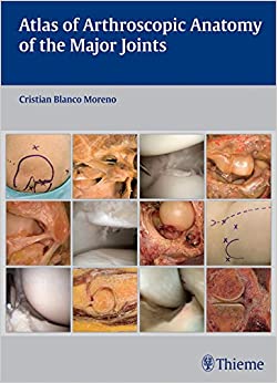 Atlas of Arthroscopic Anatomy of Major Joints