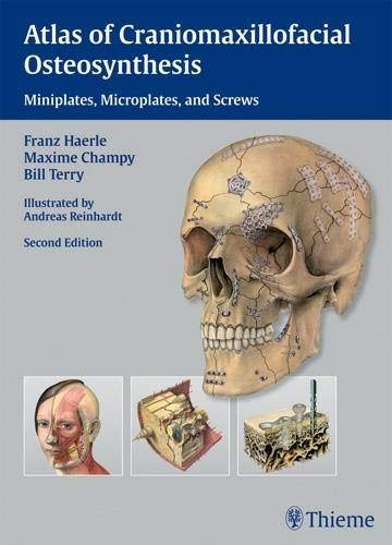 Atlas of Craniomaxillofacial Osteosynthesis: Microplates, Miniplates, and Screws