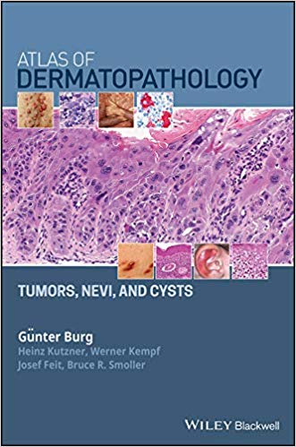 Atlas of Dermatopathology: Tumors, Nevi, and Cysts ?