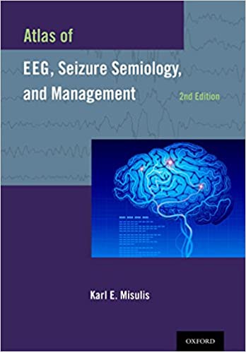 Atlas of EEG, Seizure Semiology, and Management