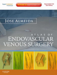 Atlas of Endovascular Venous Surgery by Jose Almeida