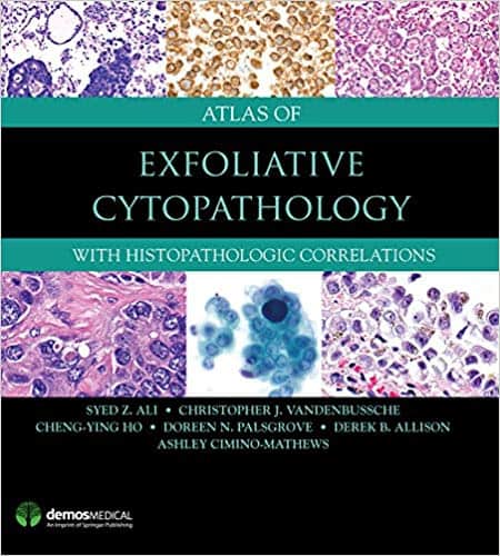 Atlas of Exfoliative Cytopathology: With Histopathologic Correlations ?