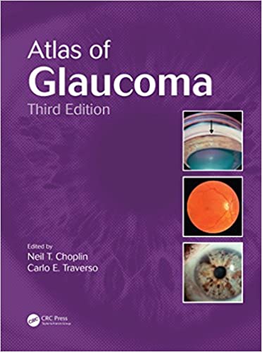 Atlas of Glaucoma