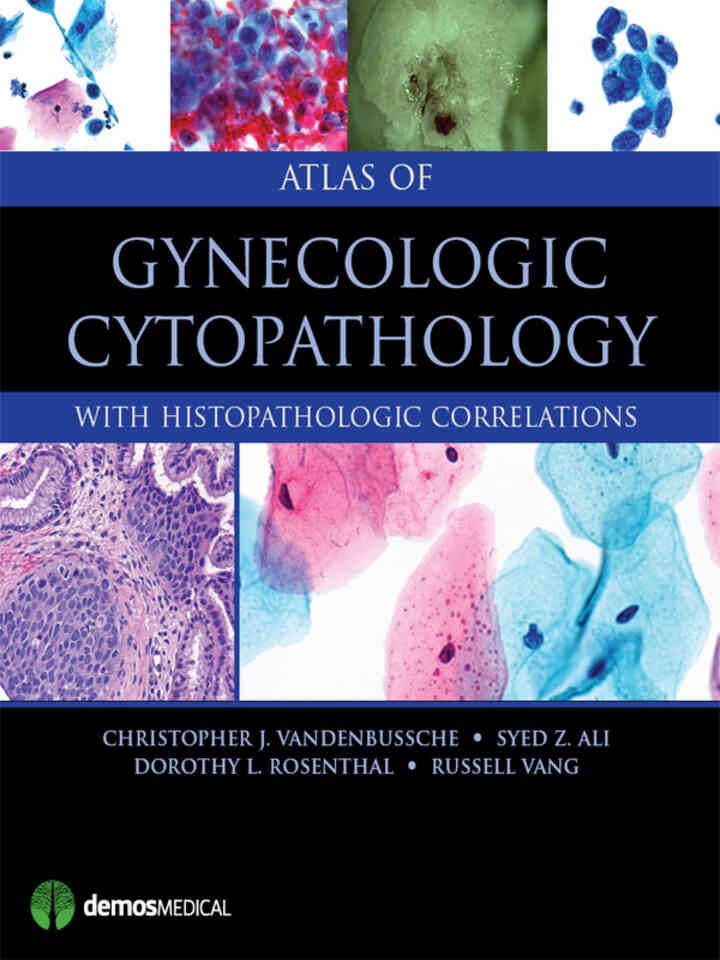 Atlas of Gynecologic Cytopathology: with Histopathologic Correlations