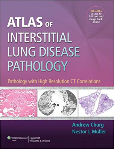 Atlas of Interstitial Lung Disease Pathology: Pathology with High Resolution CT Correlations ?