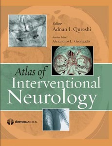 Atlas of Interventional Neurology by Alexandros Georgiadis, MD
