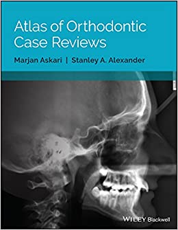 Atlas of Orthodontic Case Reviews