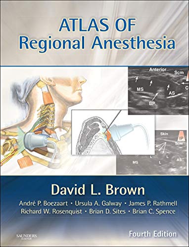 Atlas of Regional Anesthesia