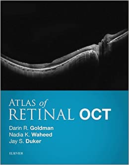 Atlas of Retinal OCT: Optical Coherence Tomography