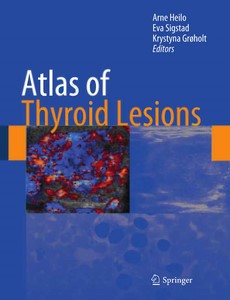 Atlas of Thyroid Lesions by Arne Heilo