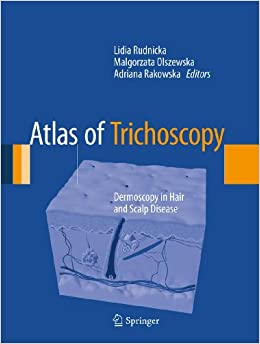 Atlas of Trichoscopy: Dermoscopy in Hair and Scalp Disease
