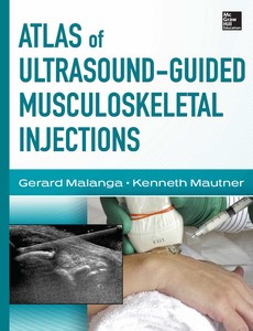 Atlas of Ultrasound Guided Musculoskeletal Injections by Gerard Malanga