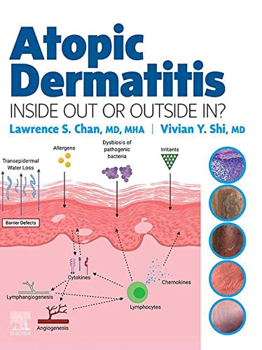 Atopic Dermatitis: Inside Out or Outside In, 1st Edition