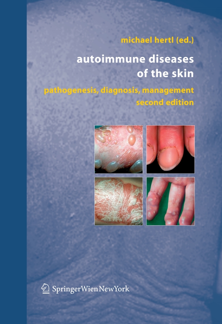 Autoimmune Diseases of the Skin: Pathogenesis Diagnosis Management