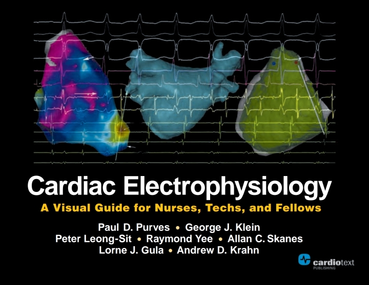Cardiac Electrophysiology: A Visual Guide for Nurses, Techs, and Fellows