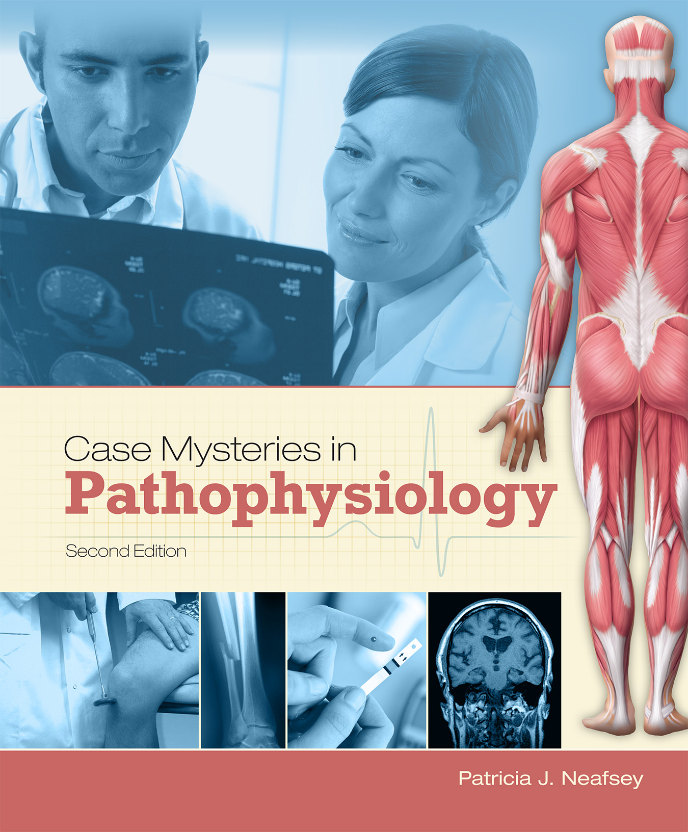 Case Mysteries in Pathophysiology 2nd Edition