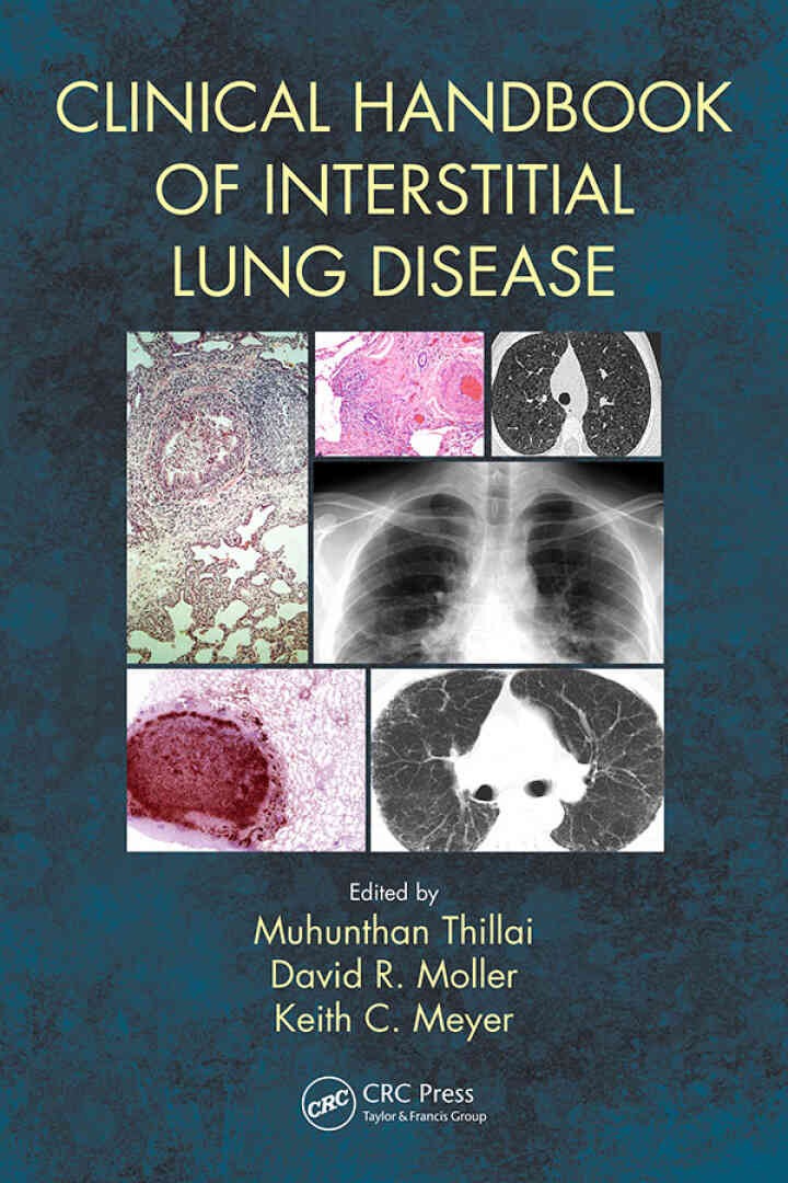 Clinical Handbook of Interstitial Lung Disease, 1st Edition