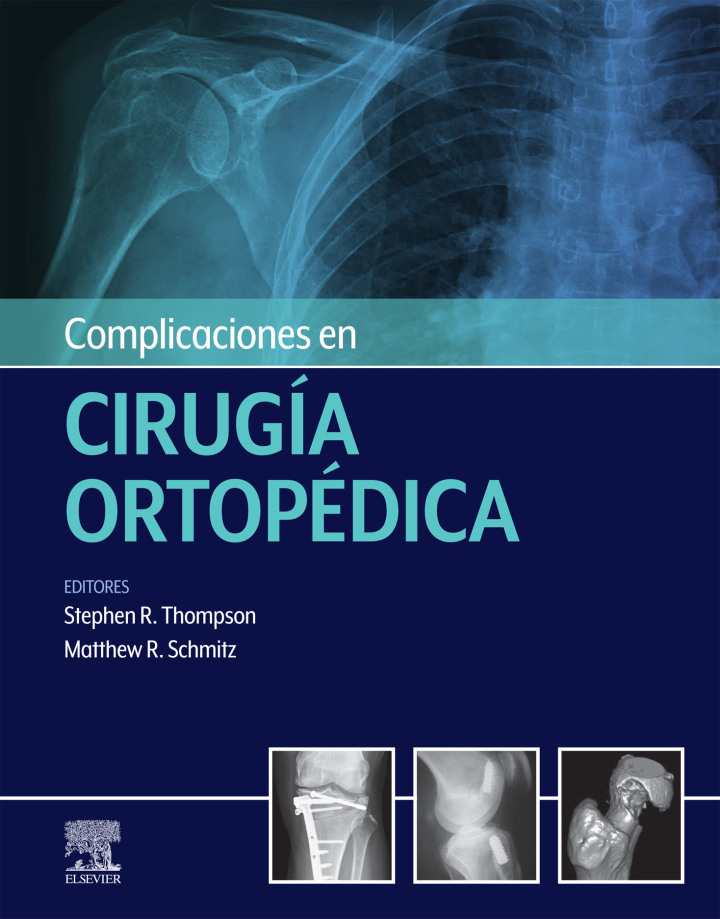 Complicaciones en cirug�a ortop�dica: Medicina deportiva