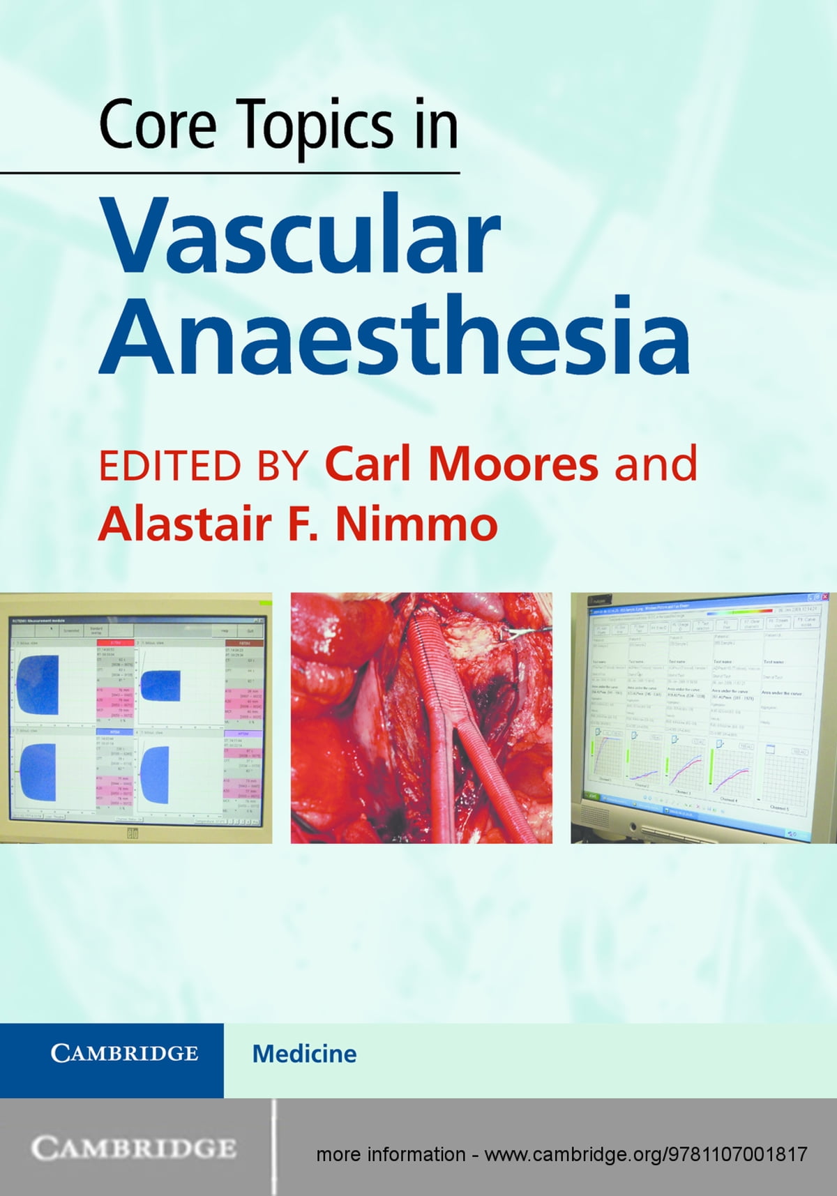 Core Topics in Vascular Anaesthesia