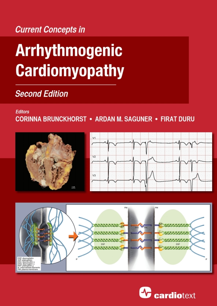 Current Concepts in Arrhythmogenic Cardiomyopathy, Second Edition