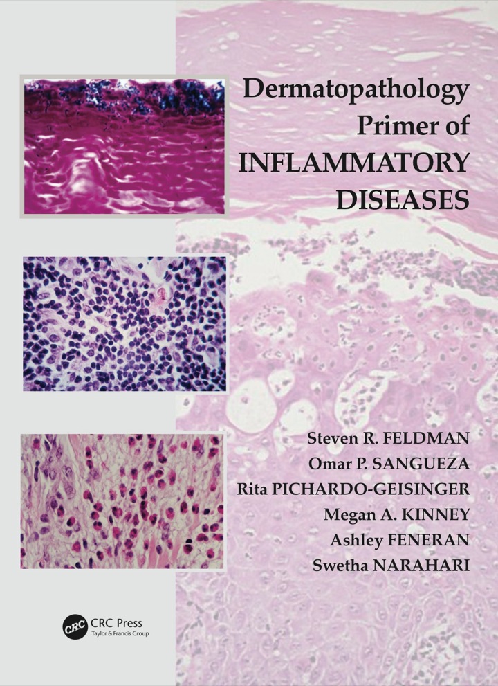 Dermatopathology Primer of Inflammatory Diseases