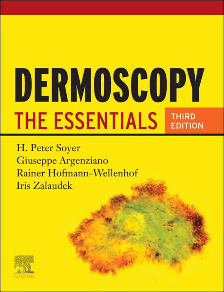 Dermoscopy: The Essentials
