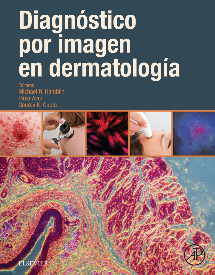 Diagn�stico por imagen en dermatolog�a