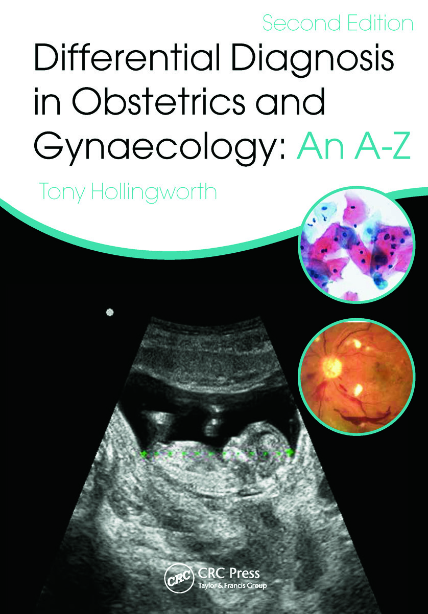 Differential Diagnosis in Obstetrics & Gynaecology: An A-Z, Second Edition
