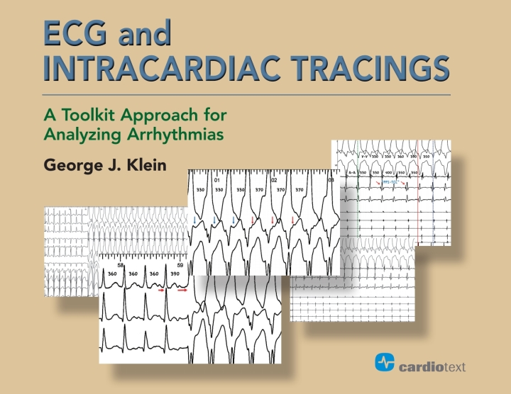 ECG and Intracardiac Tracings: A Toolkit Approach for Analyzing Arrhythmias