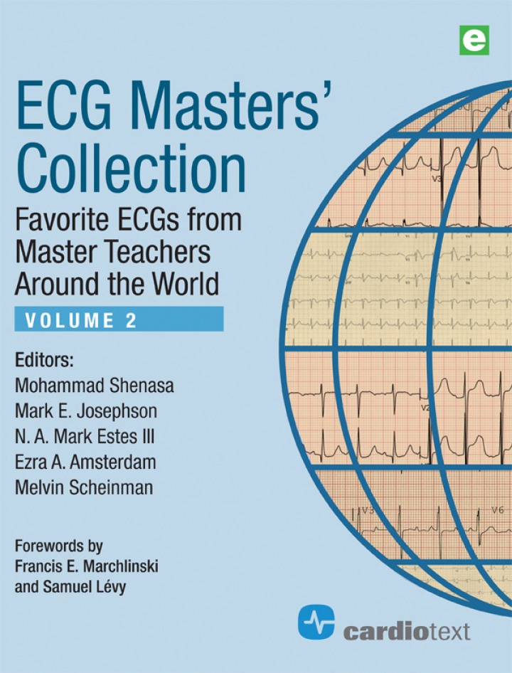ECG Masters Collection Volume 2: Favorite ECGs from Master Teachers Around the World