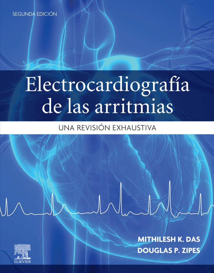 Electrocardiograf�a de las arritmias: Una revisi�n exhaustiva