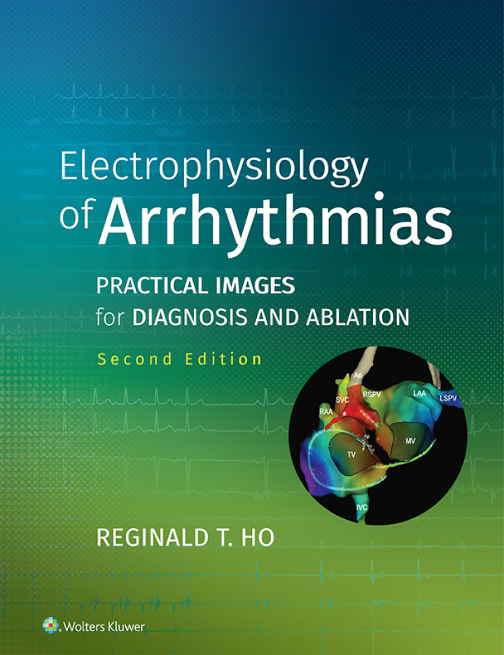 Electrophysiology of Arrhythmias: Practical Images for Diagnosis and Ablation