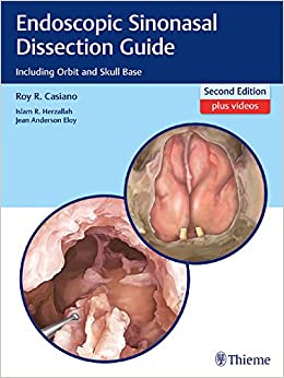 Endoscopic Sinonasal Dissection Guide: Including Orbit and Skull Base