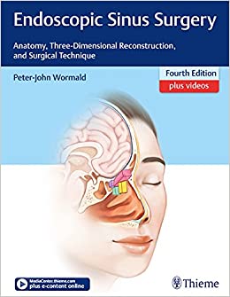 Endoscopic Sinus Surgery: Anatomy, Three-Dimensional Reconstruction, and Surgical Technique