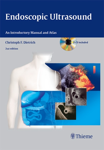 Endoscopic Ultrasound: An Introductory Manual and Atlas