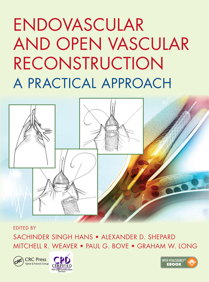 Endovascular and Open Vascular Reconstruction: A Practical Approach