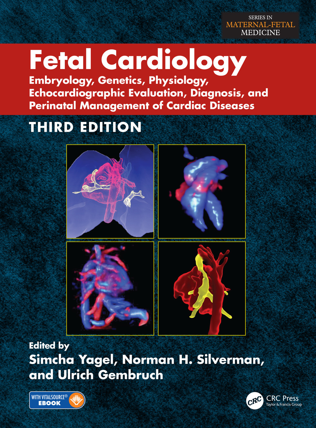 Fetal Cardiology: Embryology, Genetics, Physiology, Echocardiographic Evaluation, Diagnosis and Perinatal Management of Cardiac Diseases